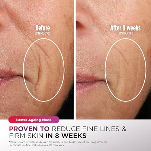 CryoGlow™ LED Facial Renewal Mask™