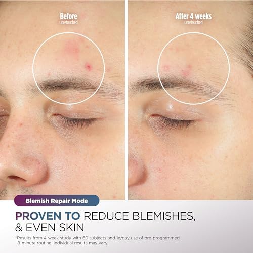 CryoGlow™ LED Facial Renewal Mask™